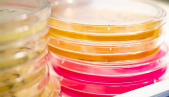 Minder voedselverspilling dankzij berekening worst case beginbesmetting Listeria monocytogenes
