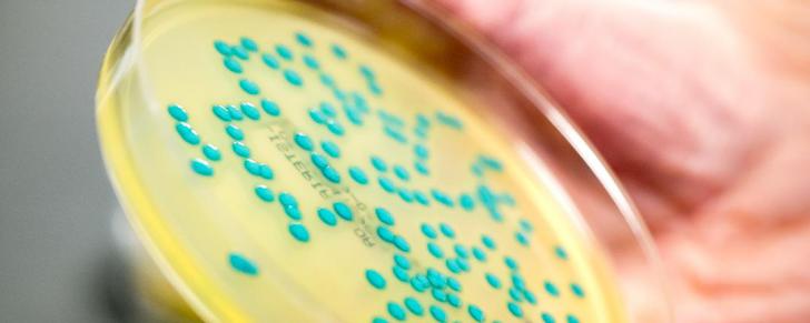 Nieuw lab voor onderzoek Listeria in gebruik genomen