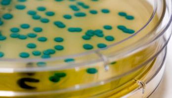 Onderbouwing voorkomen uitgroei van Listeria monocytogenes in koelverse producten