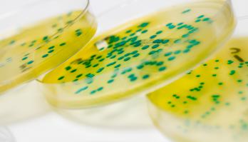 Substantiation of the Listeria growth potential combined with the optimisation of recipes